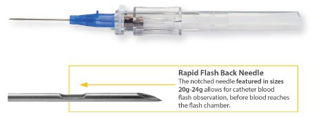 MedSource International Peripheral IV Catheter TrueSafe™ 18 Gauge 1.16 Inch Button Retracting Safety Needle - Case of 200 - MS-844182-CS