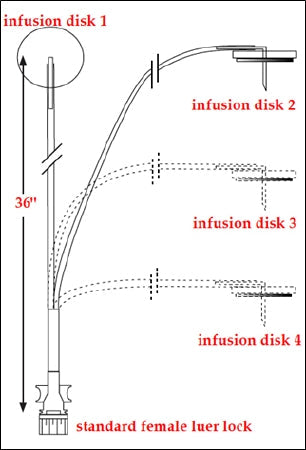 Norfolk Medical Products Sub-Q Infusion Set ClearView™ MS 24 Gauge X 2 12 mm 36 Inch Tubing Without Port - Box of 6 - SCIG52333A-BX