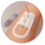 BD IV Stabilization Device Securis™ - Case of 800 - SEC0100-CS