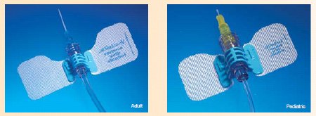 BD IV Extension Set StatLock™ Needle-Free Port Micro Bore 6 Inch Tubing Without Filter Sterile - Case of 25 - IV0564-CS