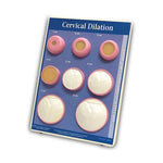 American 3b Scientific Lp Cervical Dilation Easel Displays 1012488 - 1.0 Each