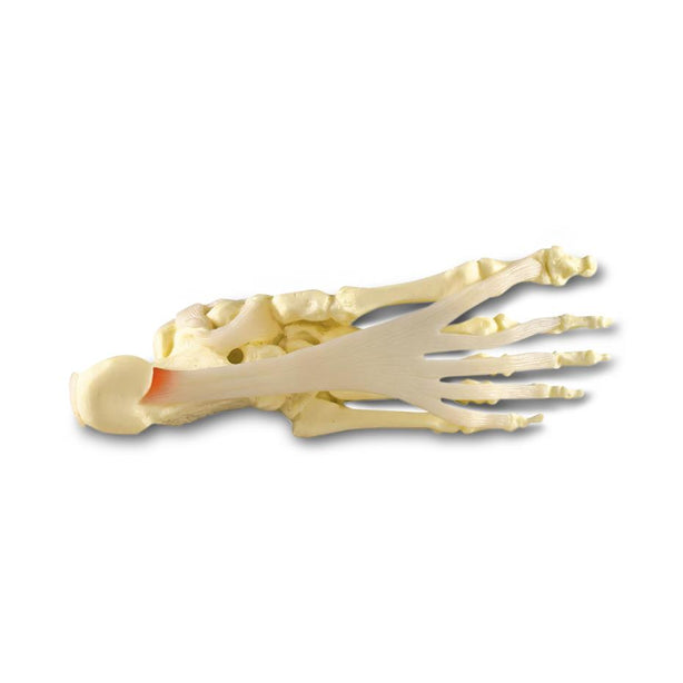 American 3b Scientific Lp 3B Scientific Foot / Ankle Plantar Fasciitis Model 1019522 - 1.0 Each