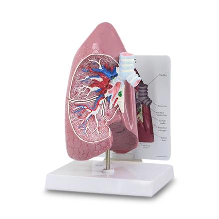 American 3b Scientific Lp Lung Model 1019545 - 1.0 Each