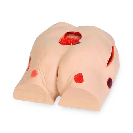 AMERICAN 3B SCIENTIFIC LP Seymour II Wound Care Simulator 1009798 1 Each