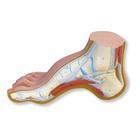 3B Scientific Hollow Foot (Pes Cavus) Model - M32 - 1 Each - MDL-ABQM32