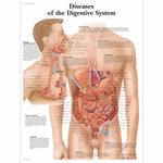 AMERICAN 3B SCIENTIFIC LP 3B Scientific Educational Posters VR1431UU 1 Each