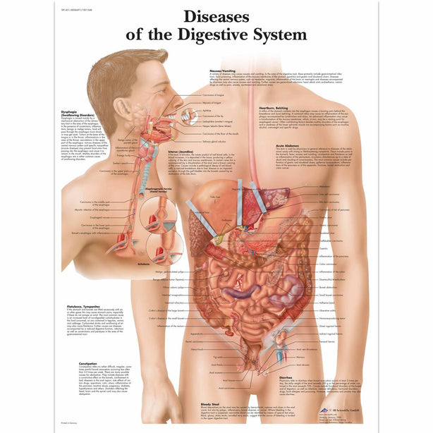 AMERICAN 3B SCIENTIFIC LP 3B Scientific Educational Posters VR1431UU 1 Each