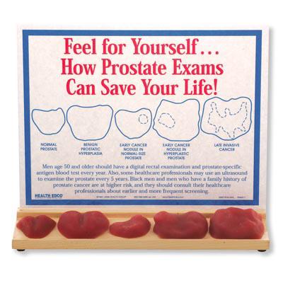 American 3b Scientific Lp 3B Scientific Prostate Exam Display W43228 - 1.0 Each