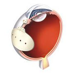 Abbott Baerveldt Glaucoma Implants BG103-250 - 1.0 Each