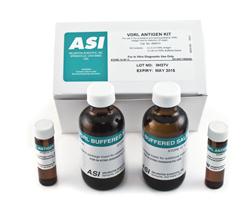 Arlington Scientific VDRL Antigen Test 950010 - 1.0 Each