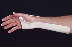 ALIMED Ulnar Gutter Wrist Splint 51-131 1 Each