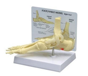 Alimed Plantar Fasciitis Foot and Ankle Anatomical Model 70574 - 1.0 Each