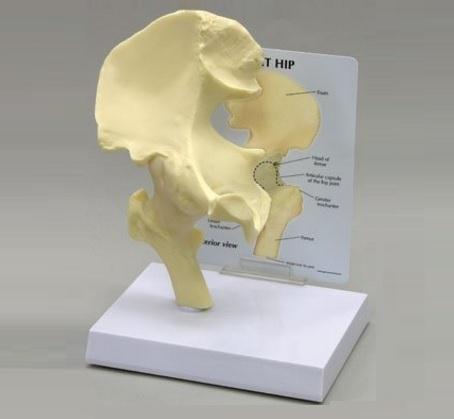 GPI Anatomicals Basic Full-Size Hip Model - 70579 - 1 Each - MDL-ALI70579