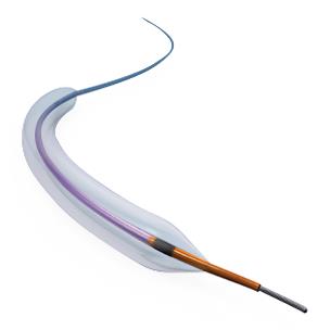 ABBOTT Mini Trek Coronary Dilatation Catheters 1012403-15A 1 Each