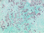 Azer Scientific GMS Stain Kit (Modified Gomori) ES3397 - 1.0 Each - MDL-AZRES3397