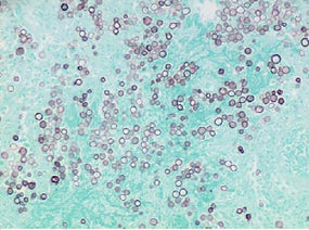 Azer Scientific GMS Stain Kit (Modified Gomori) ES3397 - 1.0 Each - MDL-AZRES3397