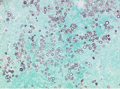 Azer Scientific GMS Stain Kit (Modified Gomori) ES3397 - 1.0 Each - MDL-AZRES3397