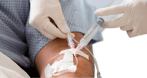 Nexiva Diffusics Closed IV Catheter System Administration Sets - 383593 - 1 Each - MDL-B-D383593H