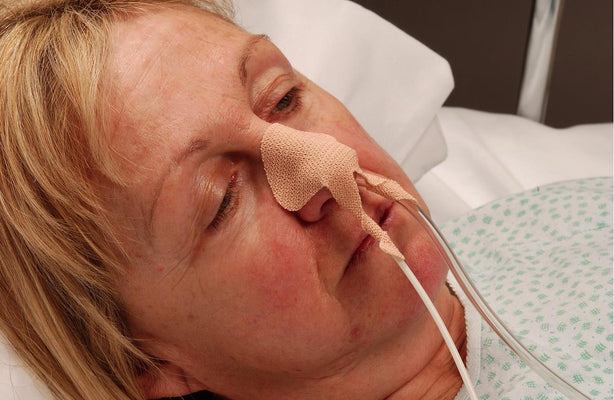 Dale Medical Nasogastric Tube Holder - 160 - 1 Each