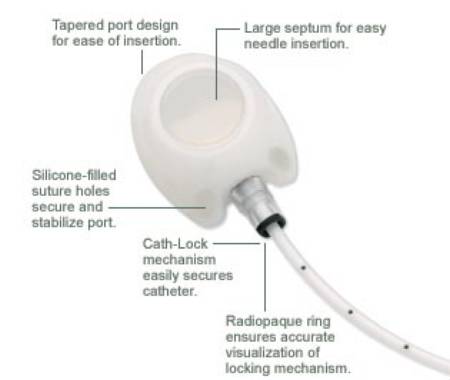 Bard Peripheral Vascular MRI Implantable Port X-Port Isp™ 8 Fr. Single Lumen - Each - 0607540-EA