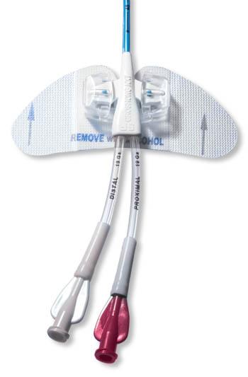 Statlock PICC II Securement Device - NN0201 - 50 Each - MDL-BARNN0201