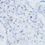 Biocare Treponema Pallidum Antibody - APA135AA - 1 Each - MDL-BCMAPA135AA