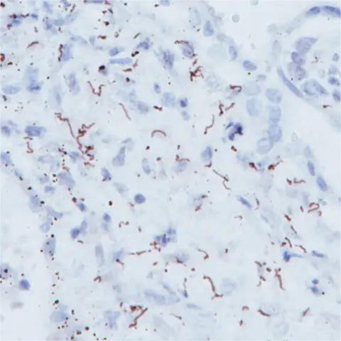 Biocare Treponema Pallidum Antibody - APA135AA - 1 Each - MDL-BCMAPA135AA