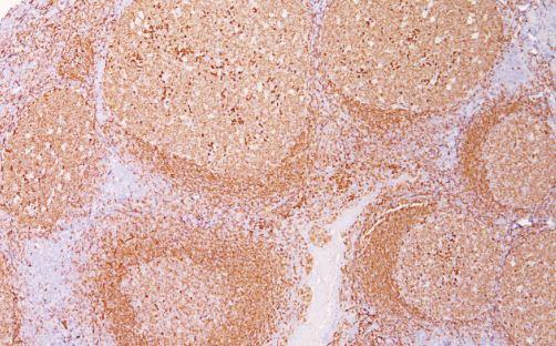 Biocare Medical CD79a Antibody CM067C - 1.0 Each
