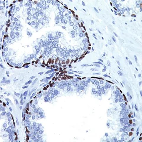 Biocare P63 Antibody Concentrate - CM163C - 1 Each - MDL-BCMCM163C
