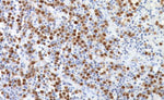 Biocare Medical MUM-1 Antibody CRM352B - 1.0 Each