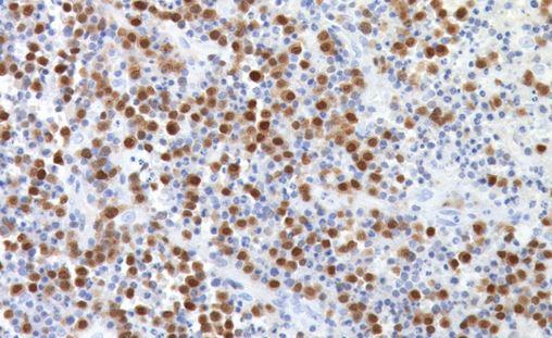 Biocare Medical MUM-1 Antibody CRM352B - 1.0 Each