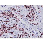 TTF-1 Antibody - PM087AA - 1 Each - MDL-BCMPM087AA