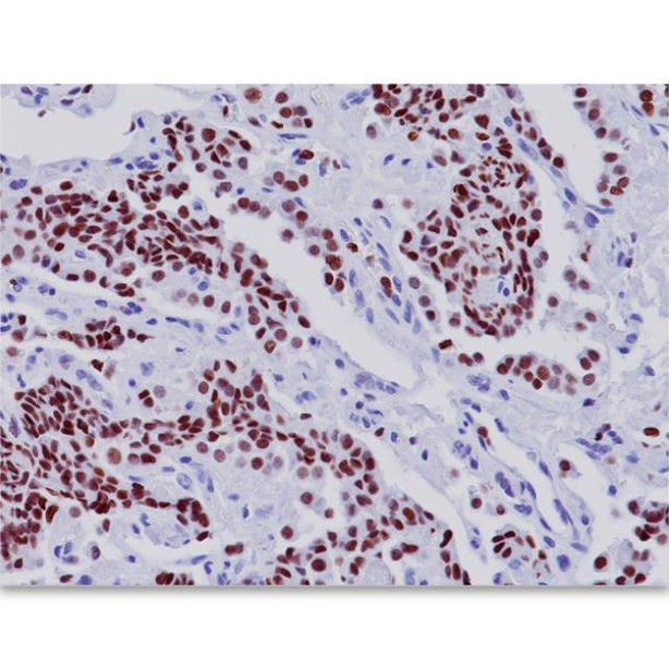 TTF-1 Antibody - PM087AA - 1 Each - MDL-BCMPM087AA