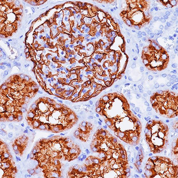 Biocare Human CD10 Antibody - PM 129 AA - 1 Each - MDL-BCMPM129AA