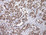 Biocare SALL4 Antibody Prediluted - PM384AA - 1 Each - MDL-BCMPM384AA