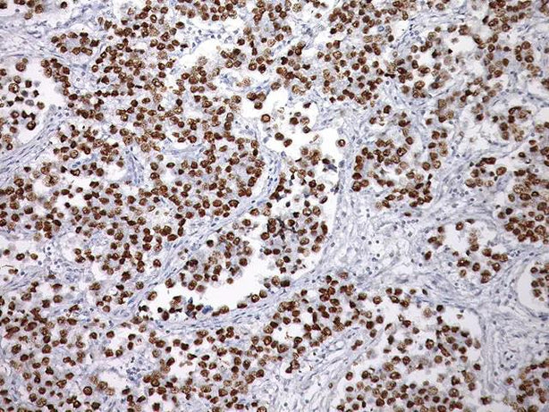 Biocare SALL4 Antibody Prediluted - PM384AA - 1 Each - MDL-BCMPM384AA
