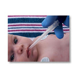 Little Sucker Suction Devices - N205 - 50 Each - MDL-BCON205