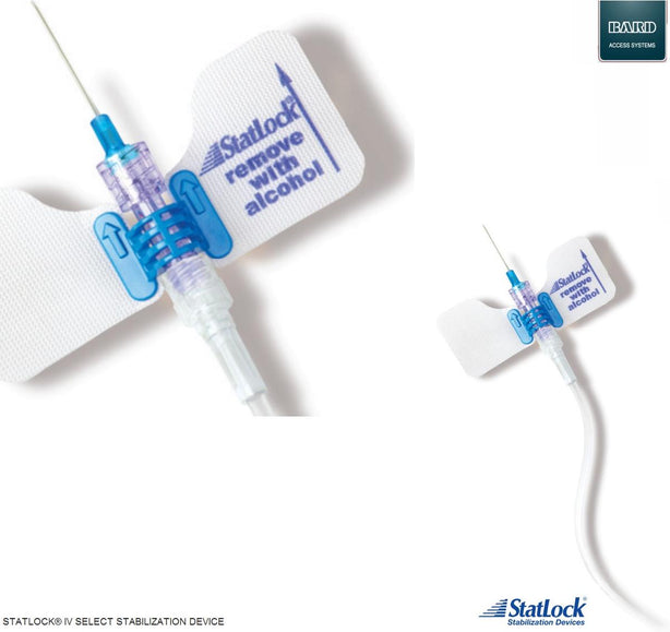 Ultrasite StatLock IV Select Stabilization Devices - IVK0118 - 50 Each - MDL-BRDIVK0118