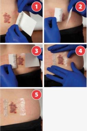 Cardinal Health First Aid-Style Bandage TD-21 - 200.0 Each - MDL-BXTTD21