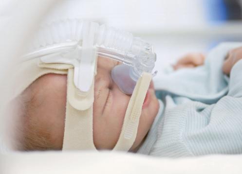 VYAIRE MEDICAL, INC. Vyaire Infant Flow LP nCPAP Accessories 7772020LP 10 Each - MDL-CFU7772020LP