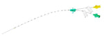 Vygon Vygon Dual Lumen Umbilical Catheters 1274.14 - 10.0 Each - MDL-CLL127414