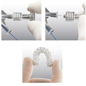 Conmed Conmed Biliary Drainage Catheters - CNDVN1008200