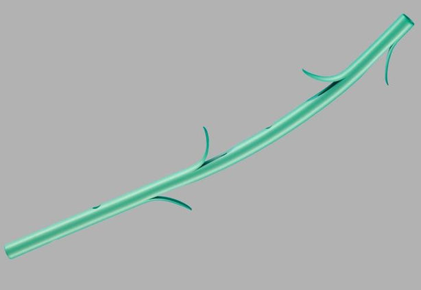 Geenen Pancreatic Stent Sets - G22113 - 1 Each - MDL-COKG22113