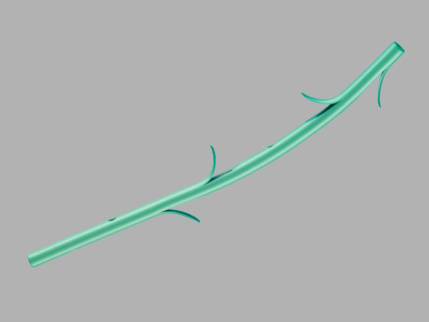 Geenen Pancreatic Stent Set, 3 Fr x 5 cm, 0.018" Wire Guide Diameter - G27181 - 1 Each
