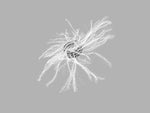 Cook Inc Cook MReye Embolization Coils G42408 - 1.0 Each