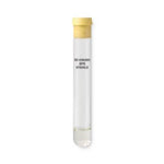 BD Vacutainer Blood Collection Tube with SPS 364960 - 100.0 Each - MDL-B-D364960Z