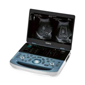 Mindray Ds Usa Inc MX7 Portable Ultrasound System 121-001971-00 - 1.0 Each