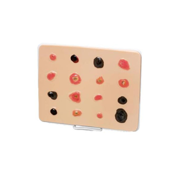 Nasco Life / form Light Skin Cancer Trainer, Enlarged - LF00950U - 1 Each