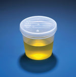 Globe Scientific Inc 5 oz Specimen Container 5917 - 300.0 Each - MDL-DLS5917
