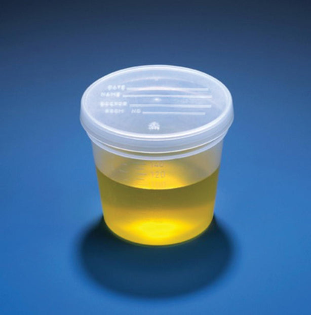 Globe Scientific Inc 5 oz Specimen Container 5917 - 300.0 Each - MDL-DLS5917
